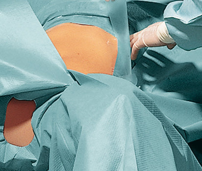 Foliodrape® Protect Plus Gynecology-ABdominal set II